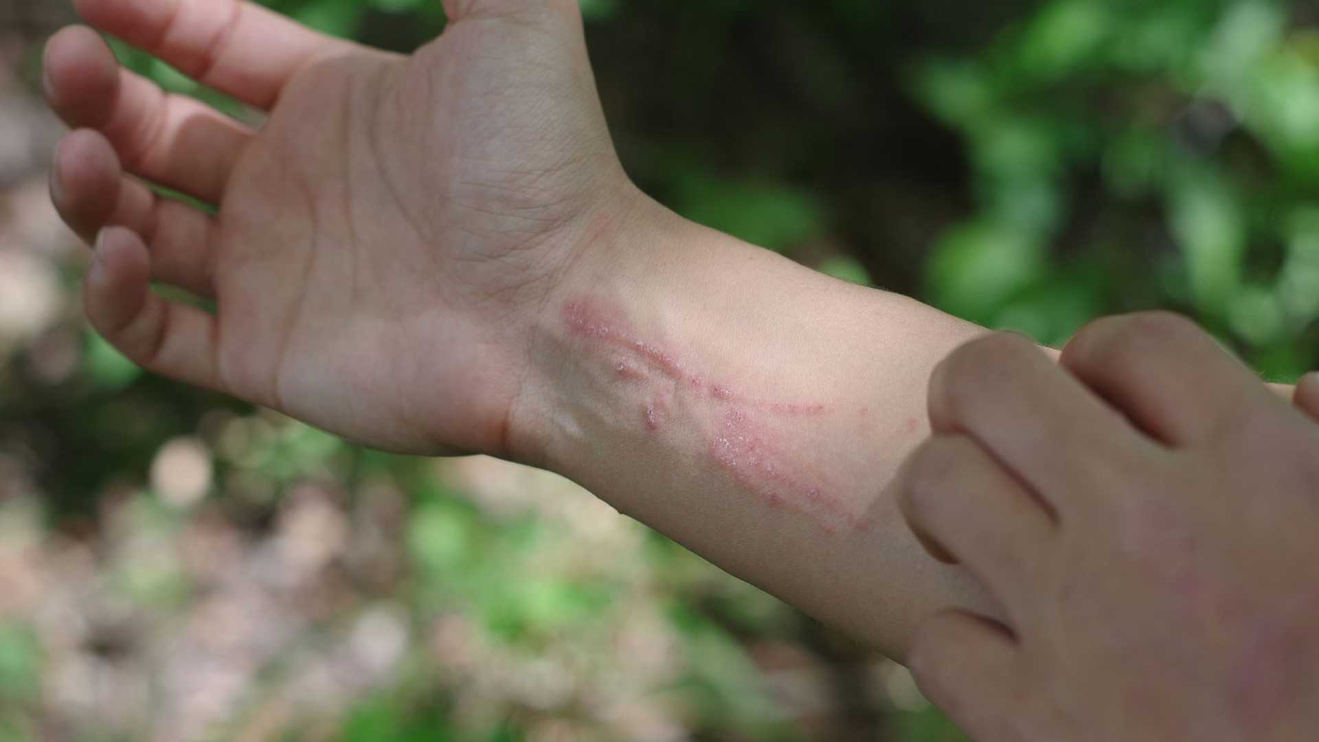 Uncover Poison Ivy like a Pro: AI Identification Guide