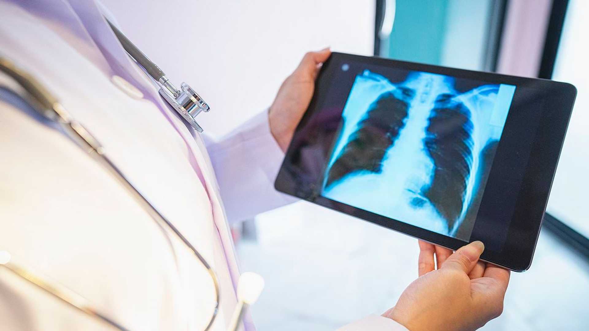 Is AI Really the Answer? The ChatGPT Fail on Live Radio